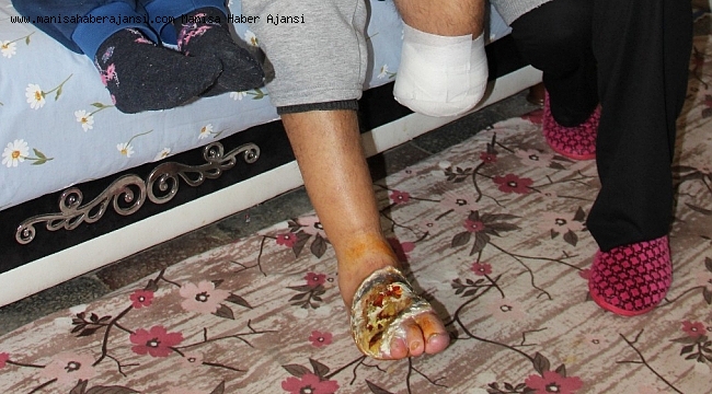 Yaşarken çürümeye başladı