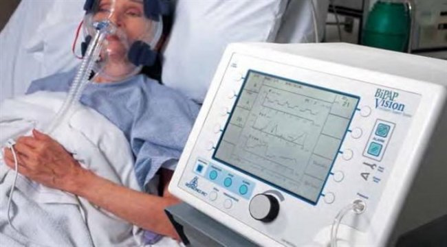 Oniki milyona sadece dört solunum cihazı