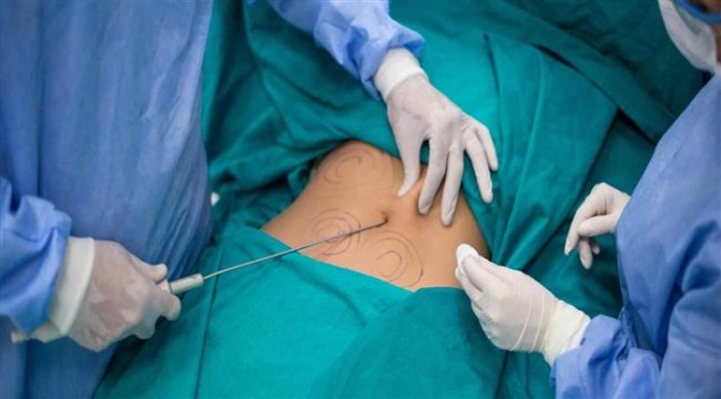 Yağ aldırma ameliyatında en çok hangi bölgeler tercih edildi?