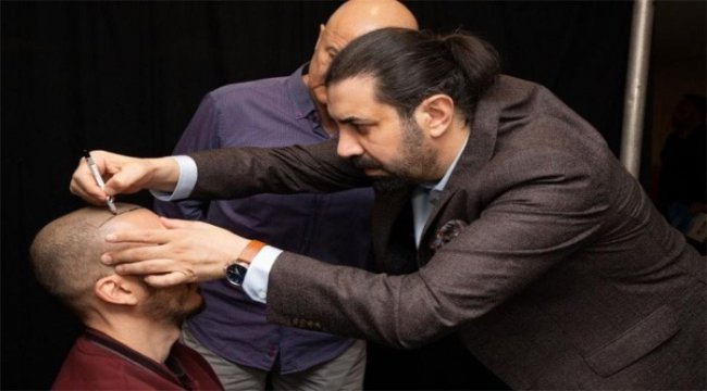 Saç ekimi öncesi tavsiyelere dikkat